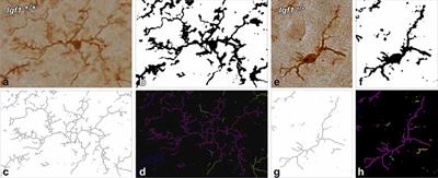 Neuroglial Involvement in Abnormal Glutamate Transport in the Cochlear Nuclei of the Igf1−/− Mouse